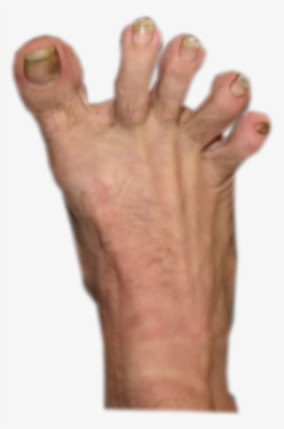 [ann] [rt2] - Pies Feos De Hombres #5221772