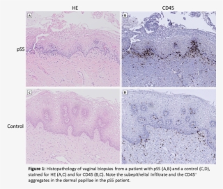 Beschrijving - Beschrijving - Beschrijving - Beschrijving - Mountain #5263832