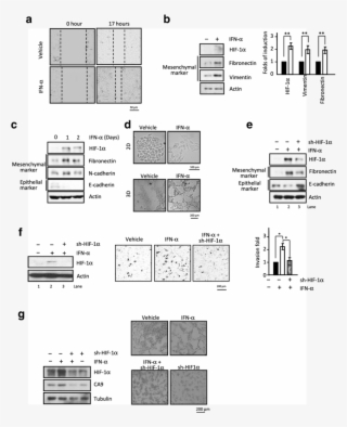 Funtional Hif 1α Expression Plays A Critical Role In - Common Fig #5328967
