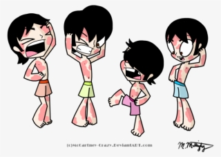 Itchy Rash Clipart - Rash Cartoon Png #5373955
