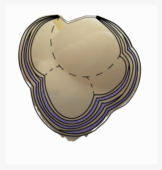 Plaster Layers Would Only Cover Half Of The Balloon, - Circle #5389451