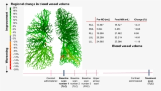 Frc, Functional Residual Capacity - Blood Vessel #5399841
