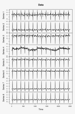 Electrocardiography Recordings Of A Pregnant Woman - Common Fig #540093