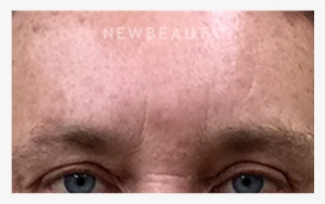 Dr Dav - Close-up #541432