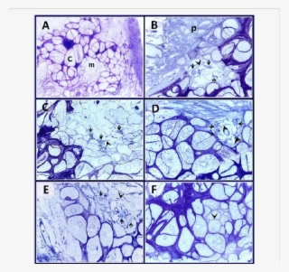 Semi-thin Sections Stained With Toluidine Blue #5491026