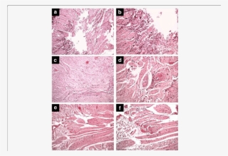 Effect Of Treatment With Copaiba Oil-resin On Transfixing - Motif #5546645