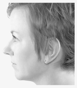 Microlaserpeel - Girl #5615095 Microlaserpeel - Girl #5615095