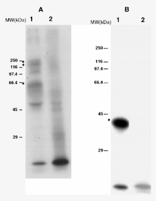 B Trypomastigote Forms From Cell Cultures - Monochrome #5657205