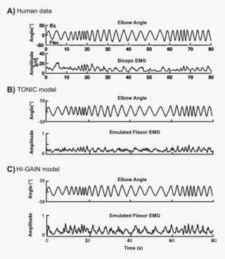 Biceps Emg During Arm Rotation In A Child With Hypertonic #5663857