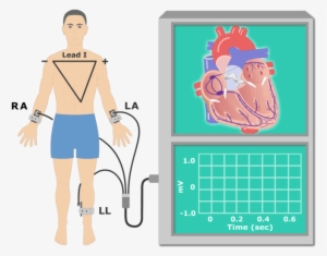 The P Wave Ekg Recording Animation Slide - Electrocardiography #574382