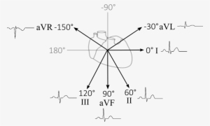 Cardiac Vector Ekg Jpg Black And White Download - Diagram #574700