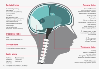 Symptoms Based On Brain Tumour Location The Brain Tumour - Brain Tumor #5726380
