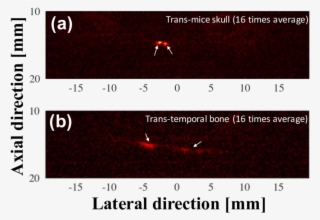 Preliminary Ex Vivo Photoacoustic Imaging Results For - Photoacoustic Imaging #5752683