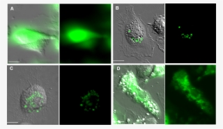Pub2 - Laser #5770624