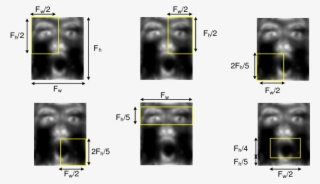 Au Regions Highlighted On A Surprise Gabor Face - Computed Tomography #5770625