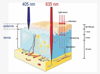 The Principle Of Photodynamic Therapy And Commonly - Penetration In Red Light #5773578