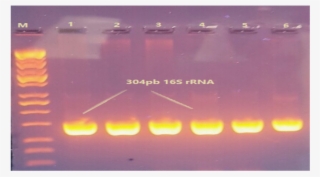 Agarose Gel Electrophoresis Of Amplified 16 Srrna Gene - Agarose Gel 16s #5788935
