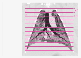 Coronal Plane Reconstruction Of A Representative Animal - Coronal Plane #5838790