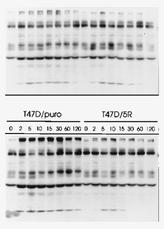 Total Phosphotyrosine Blot Of Egf And Ndf Induced T47d/puro - Monochrome #5852075