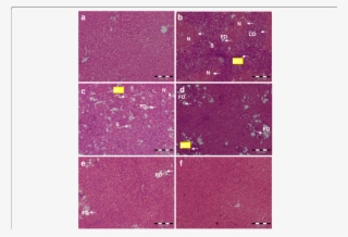 Effect Of C - Histopathology #5885568