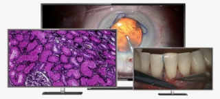 Large 4k Uhd Monitors For Displaying Pathology, Ophthalmology, - Led-backlit Lcd Display #5918496