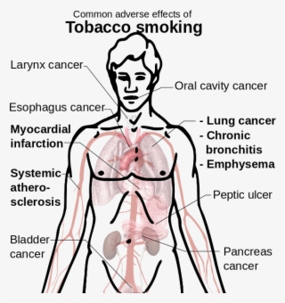 Drawn Cigarette Effect Tobacco #5966566