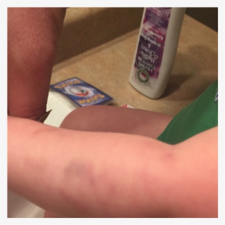 Ella At Daycare Is Biting You - Mobile Phone #5987168