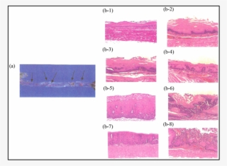 Various Pathological Lesions Induced By Nmba In A Rat - Dysplasia #5999954