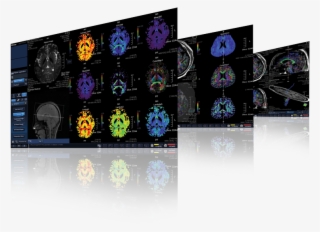 M-power Technology - Magnetic Resonance Imaging #6096420