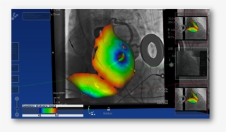 Turning The Bags Of Numbers Coming From Measurements - Portable Network Graphics #6246190