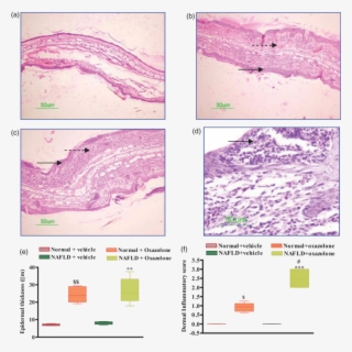 Effect Of Oxazolone On Ear Histopathology In Normal - Mouse Ear Inflammation Histo #6258567
