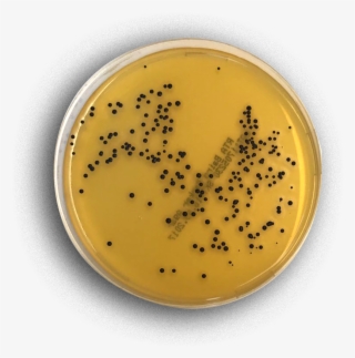 Baird Parker Agar - Baird-parker Agar #6261731