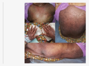 A Shawl Sign - Shawl Back #630054