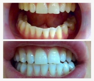 Everyone Feels Better When They Have Great Looking - Tongue #6333966