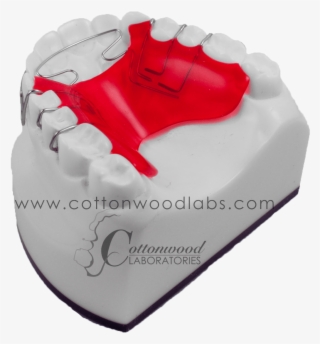 More Control Over Anterior Wire That Contacts The Teeth, - Birthday Cake #6382415