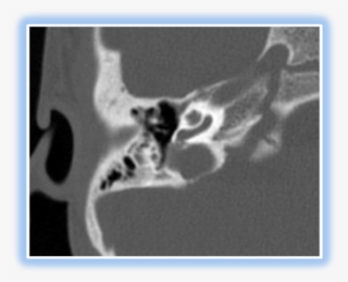 Slide0018 Image089 04 Nov 2009 - X-ray #6398822