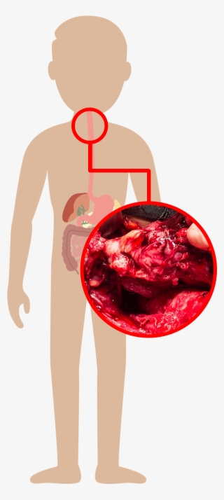 Mouth - Illustration #6407724