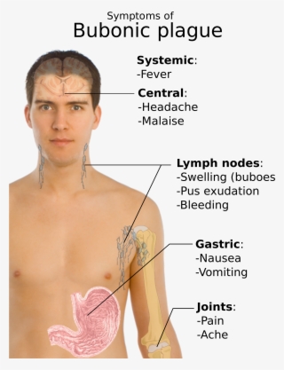 Open - Bubonic Plague Symptoms #6433466