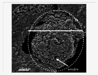 Omental Milky Spot On Greater Omentum Observed By Sem - Greater Omentum #6434167