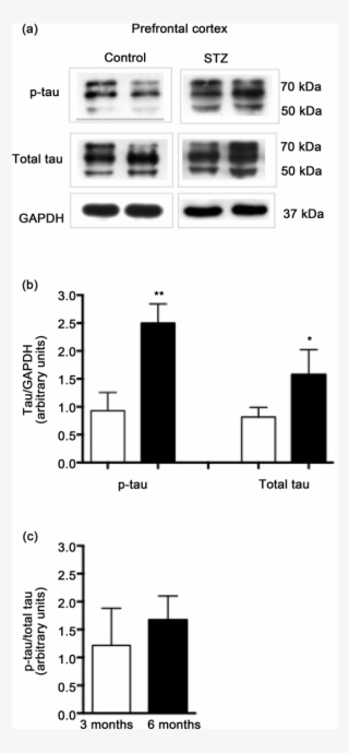 Stz Effect On P-tau In Prefrontal Cortex #6452972