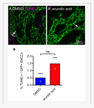 Effect Of Arundic Acid On Encc Cell Death In E13 - .org #6453549