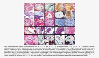 Adulterations Of Hawawshi Samples With Plant Tissues - Tissue #6476760