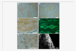 Comparison Between The Cuticle Of Eobowenia Incrassata - Pavement Cells #6484318