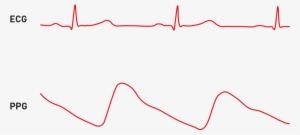 The Two Signals - Ecg Ppg #650835