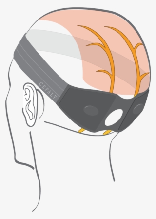 Occipital Neuralgia #6578417