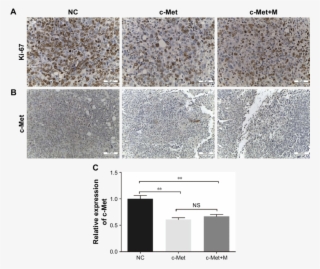 Histological Examination Of Ki #6657089