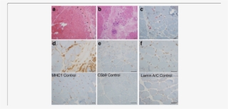 A Hematoxylin Eosin Staining Shows Prominent Perifascicular #6670230