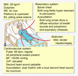 He Has Smoked For A Total Of 62 Pack Years, And Has #6734692