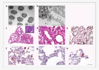 Electron Microscope Images Of The Cardamones Variant #6734782