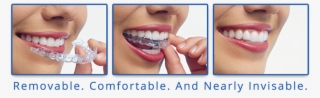 Implant Dentist Sydney Beautify Your Smile Without #6881891